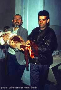 injured civlians in chechen war 1994-1995